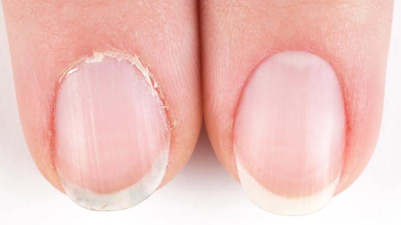 ¿Cortar o empujar? Haz el test y averigua si conoces las normas para una manicura segura.