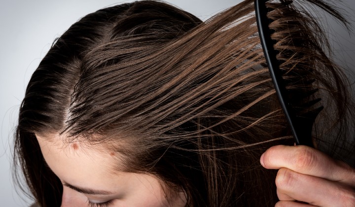 Cuero cabelludo graso: cómo solucionar el problema y empezar a lavarse el pelo con menos frecuencia