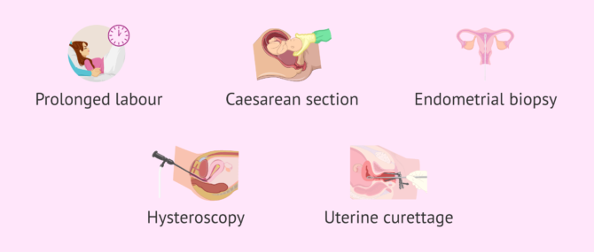 Endometritis crónica y FIV