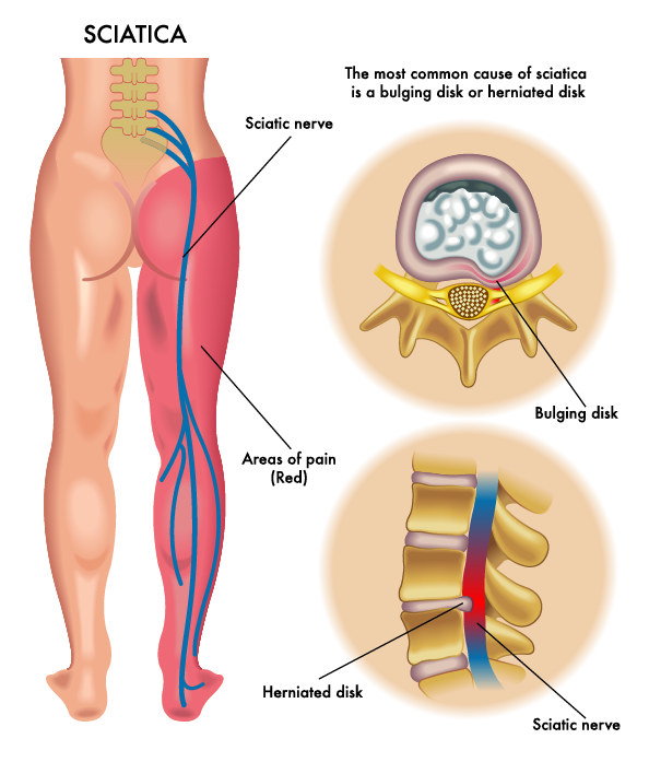 7. Dolor crónico