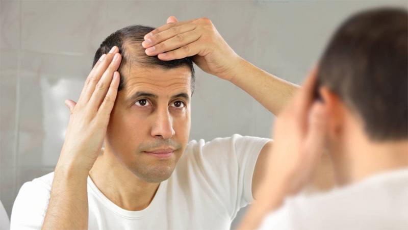 Caída estacional del cabello: cuándo es el momento de dar la alarma y correr al médico