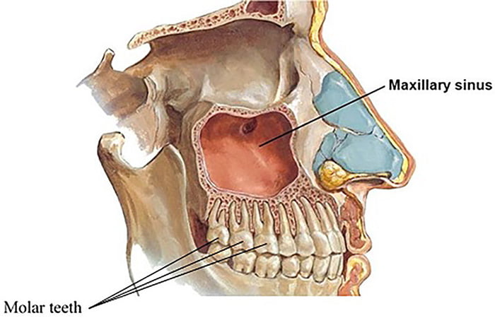 Dientes y sinusitis maxilar: cómo se relacionan y qué tratar primero