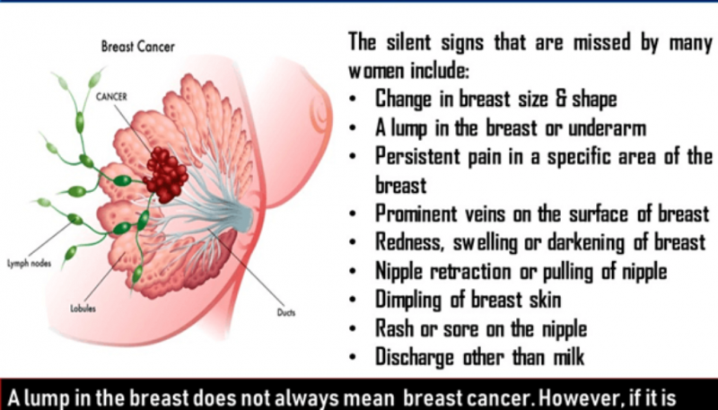 Cómo no pasar por alto las enfermedades mamarias: síntomas alarmantes y exámenes importantes