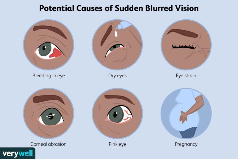 3. Examen de los ojos con dilatación