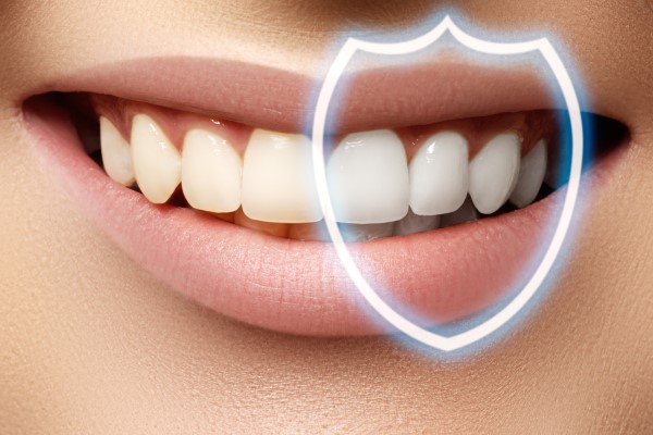 Blanqueamiento dental: si se debe hacer, cuál elegir y cómo prolongar el efecto