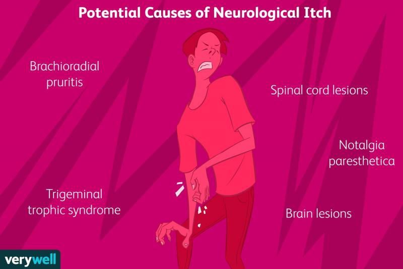 Picor nervioso: cómo acabar con el picor en medio de las preocupaciones