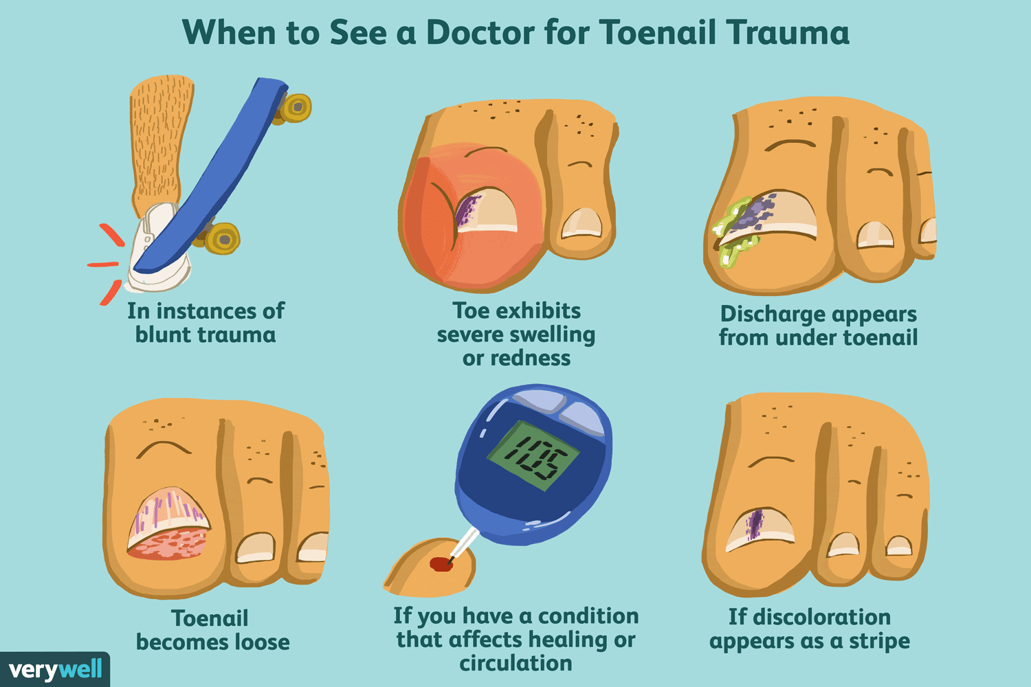 Cómo cortar correctamente las uñas de los pies: preparación