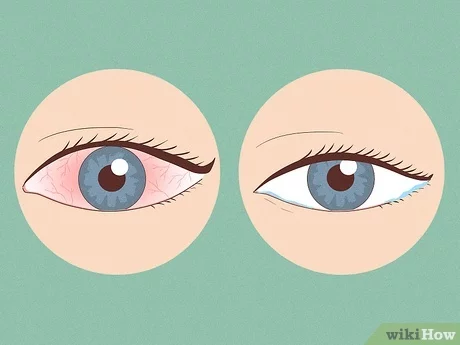 Espejo del alma: 5 pasos para cuidar bien los ojos