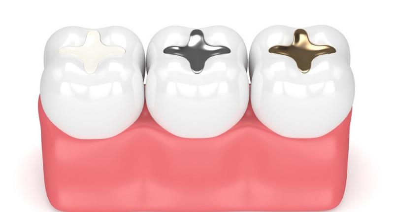 1. ¿Qué ocurre si un diente cariado se restaura con un empaste?