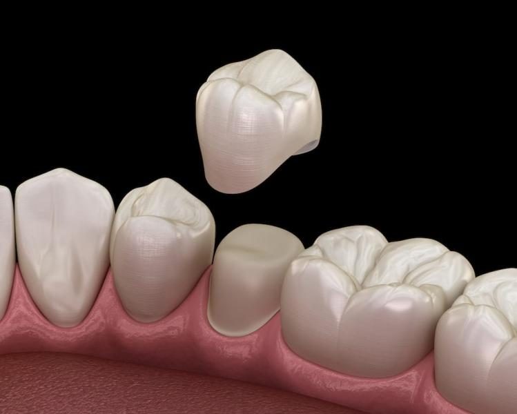 illustration-of-a-dental-crown-8033899