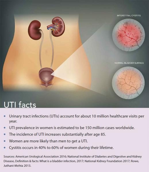 diagnosis-treatment-prevention-cystitis-uti-facts-4786564