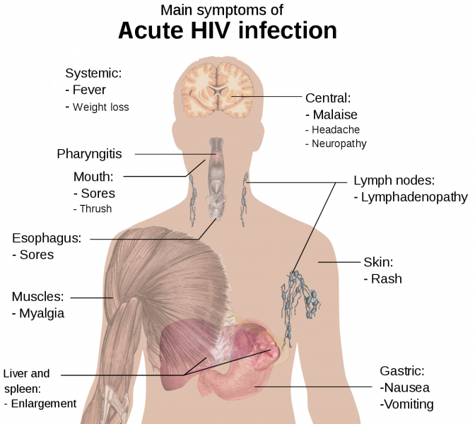 1200px-symptoms_of_acute_hiv_infection-svg_-3239777