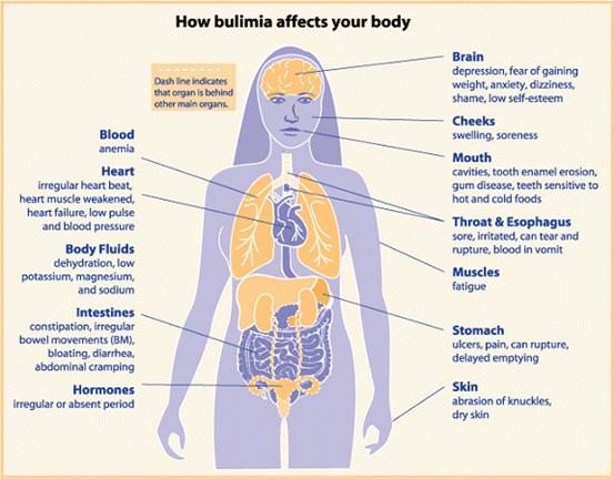 how-bulimia-affects-your-body-9901943