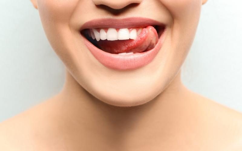 teeth-care-1080x675-8139583