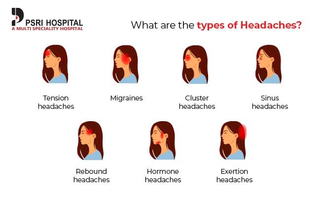 what-are-the-types-of-headache-2485615