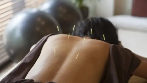 Acredita-se que uma das maneiras pelas quais a acupuntura funciona é estimulando a produção de endorfinas, que são os analgésicos naturais do corpo. Isso pode ajudar a reduzir a intensidade e a frequência das ondas de calor e dos suores noturnos, proporcionando alívio às mulheres que estão passando pela menopausa.