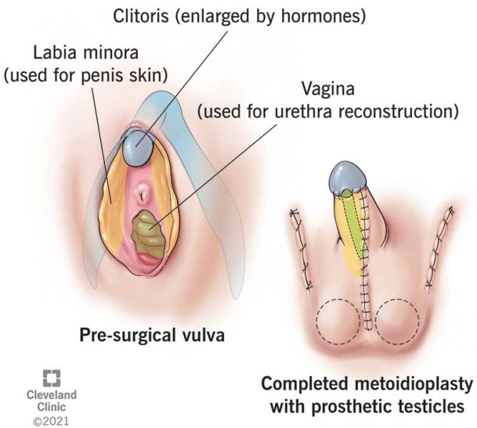 1. Alterações hormonais