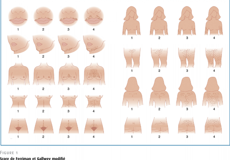 Procedimento