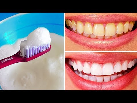 É possível clarear os dentes em casa?