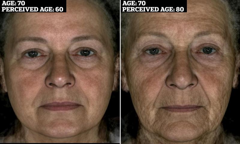 Você já se perguntou se parece mais velho do que sua idade real? O envelhecimento é um processo natural que afeta a todos de forma diferente. Algumas pessoas parecem envelhecer graciosamente, enquanto outras parecem mais velhas do que a idade que têm. Mas quais fatores contribuem para que você pareça mais velho do que realmente é? É a genética, as escolhas de estilo de vida ou uma combinação de ambos?
