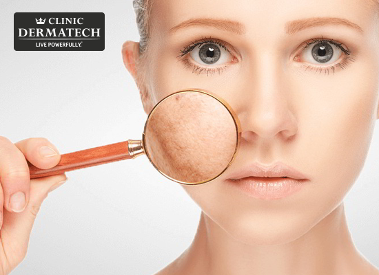 5 causas não óbvias de pigmentação no rosto e como lidar com elas