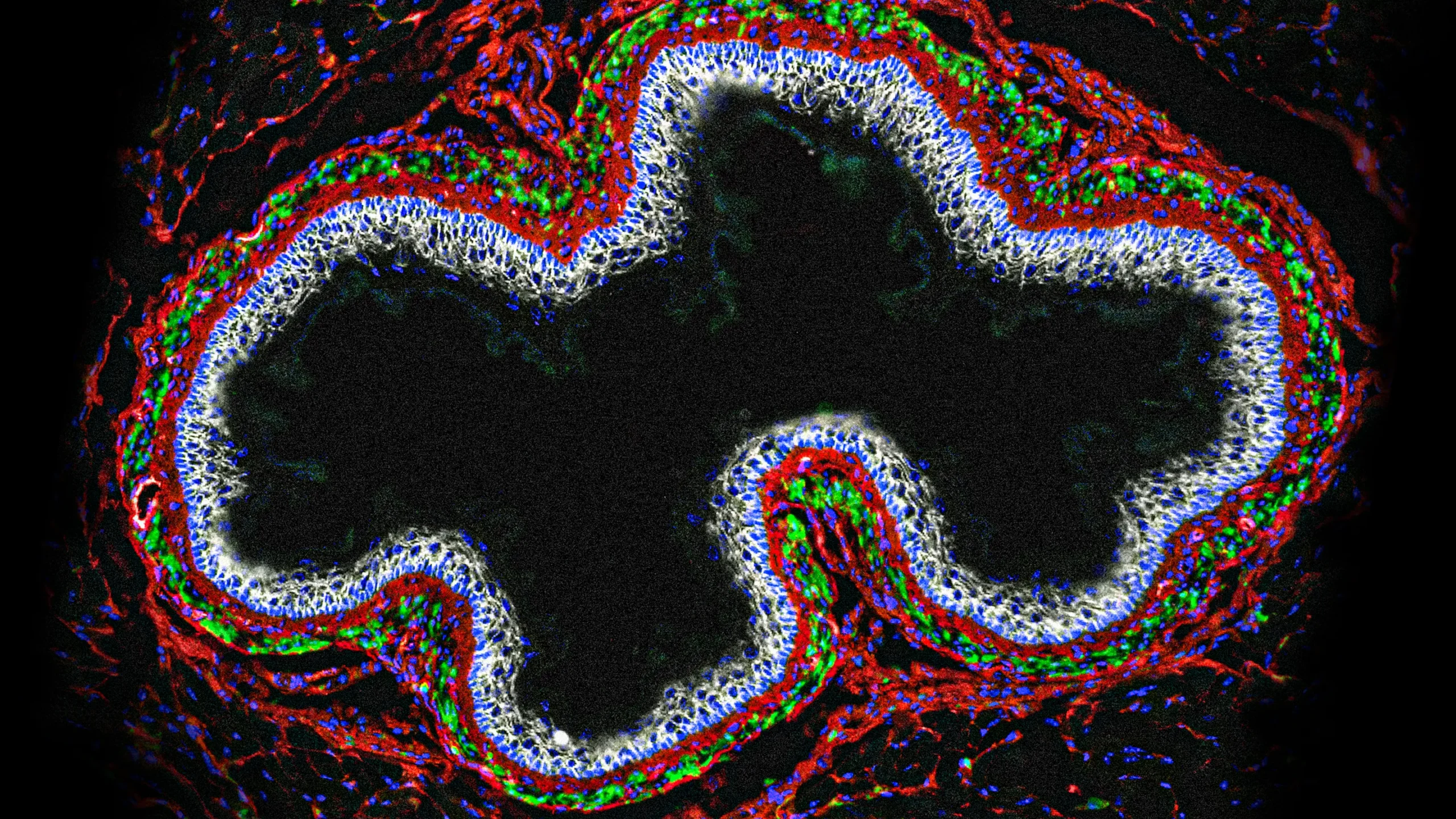 Segundo cérebro: como o intestino gerencia sua saúde