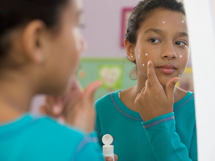 Barato e caro: a pomada de zinco é a salvação da acne