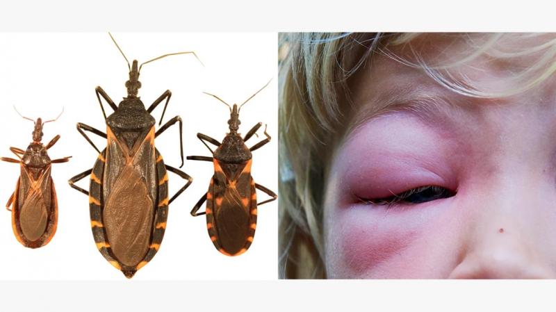 Perigoso! Picadas de insetos: prevenção e tratamento