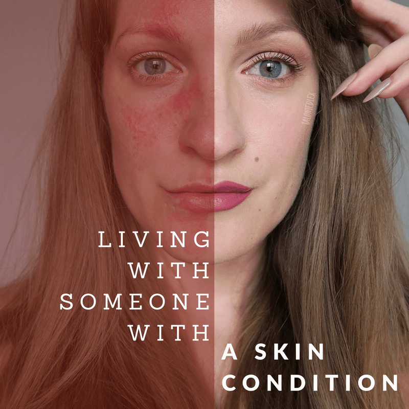 O que afeta a pele