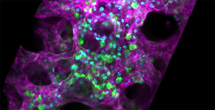 Os cientistas descobriram uma nova maneira de reparar as células pulmonares