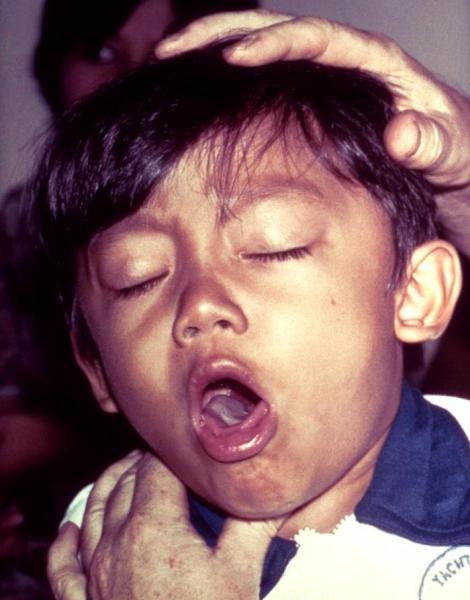 Psicossomática da tosse: 6 causas que não têm nada a ver com ARVI