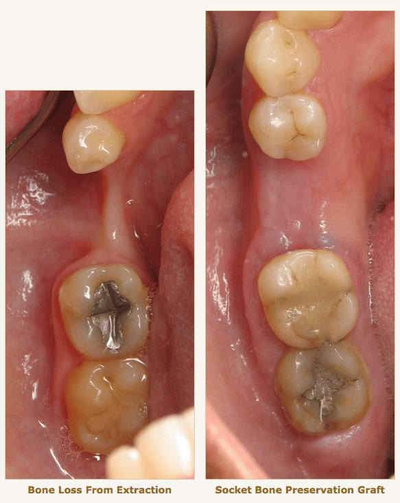 2. Dores de cabeça