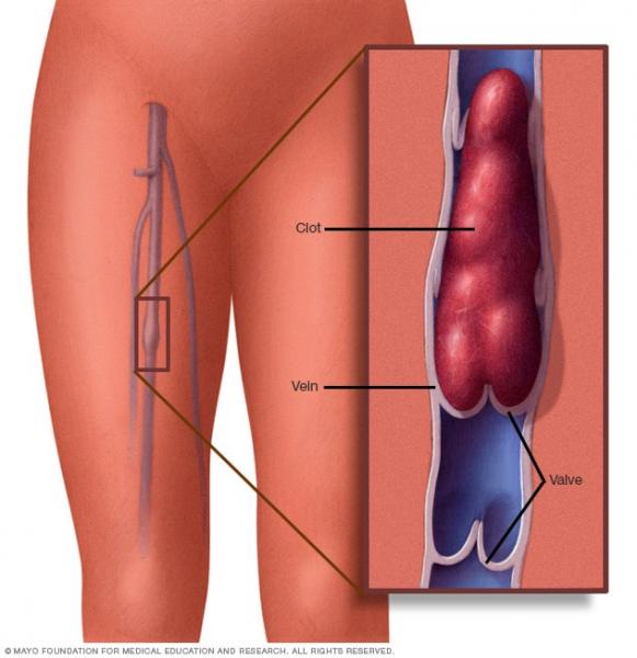 Recomendações para prevenção