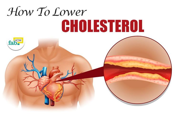 Como reduzir o colesterol: 8 maneiras (sem tomar medicamentos)