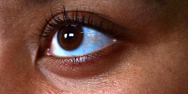 4 truques de beleza para ajudar a remover rugas, inchaço e hematomas ao redor dos olhos