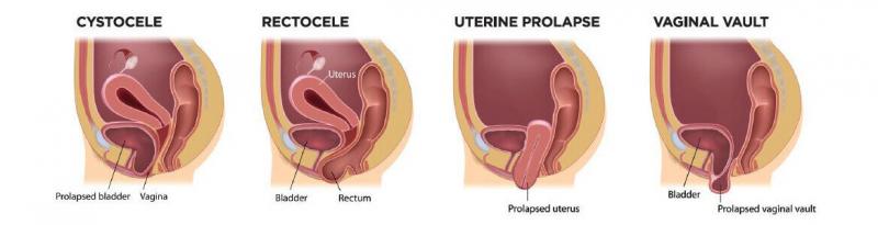 2. Técnicas de abordagem abdominal