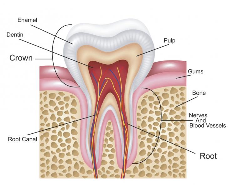 Quando remover a raiz de um dente