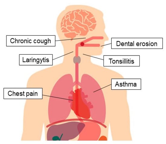 Endoscopia digestiva alta