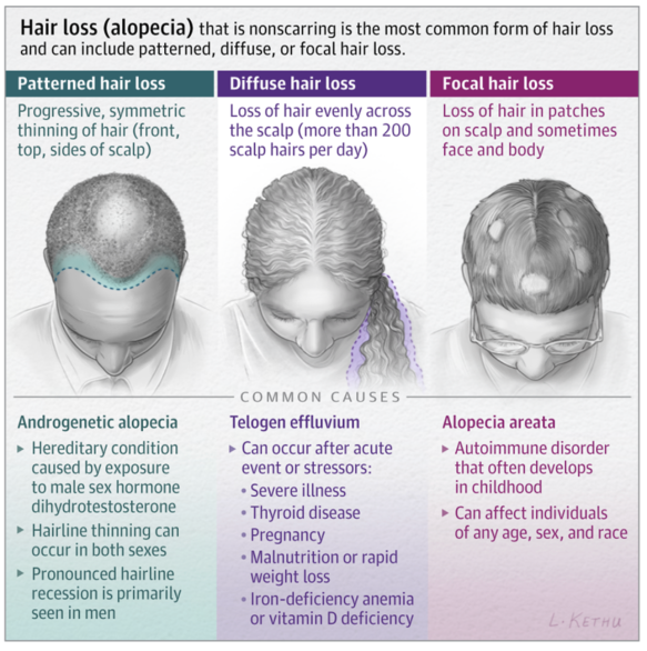 Queda de cabelo: causas e 8 maneiras reais de detê-la