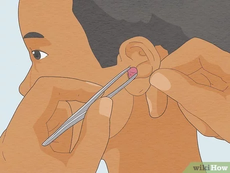 4 maneiras comprovadas de remover os protetores de ouvido em casa