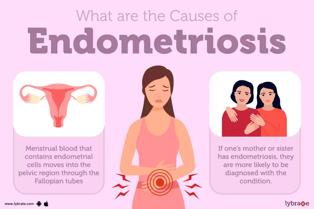 Endometriose infiltrativa profunda: