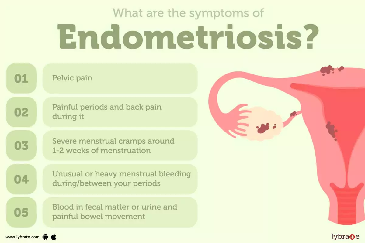 Endometriose (sintomas e tratamento)