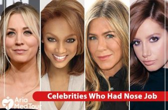 celebrities-who-had-nose-job-1-5801261